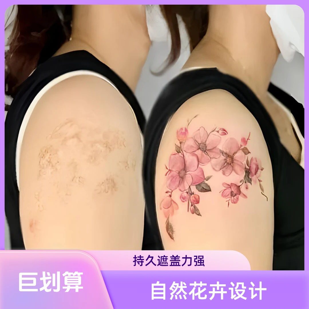 成都沐澄刺青纹身遮盖 疤痕胎记妊娠纹旧纹身 纹身修改 纹身贴