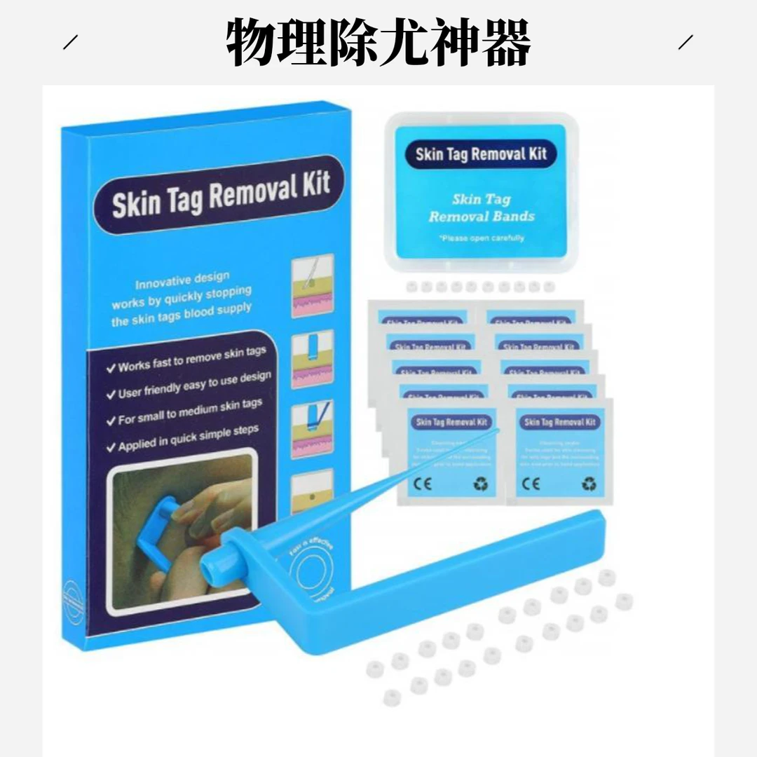 物理除小电子神器除尤神器物理除肉粒候子脖子腋下子的候子去皮赘