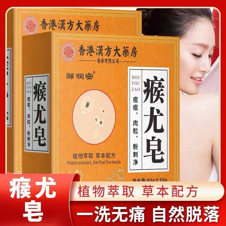 【亏本包邮】瘊尤皂丝状肉粒瘊子粉刺痘痘皮肤抑菌外用草本手工皂