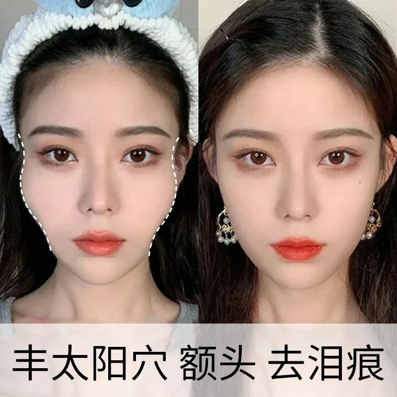 【面部凹陷修复】脸部丰盈精华液丰太阳穴泪沟法令纹皱纹填充脸颊