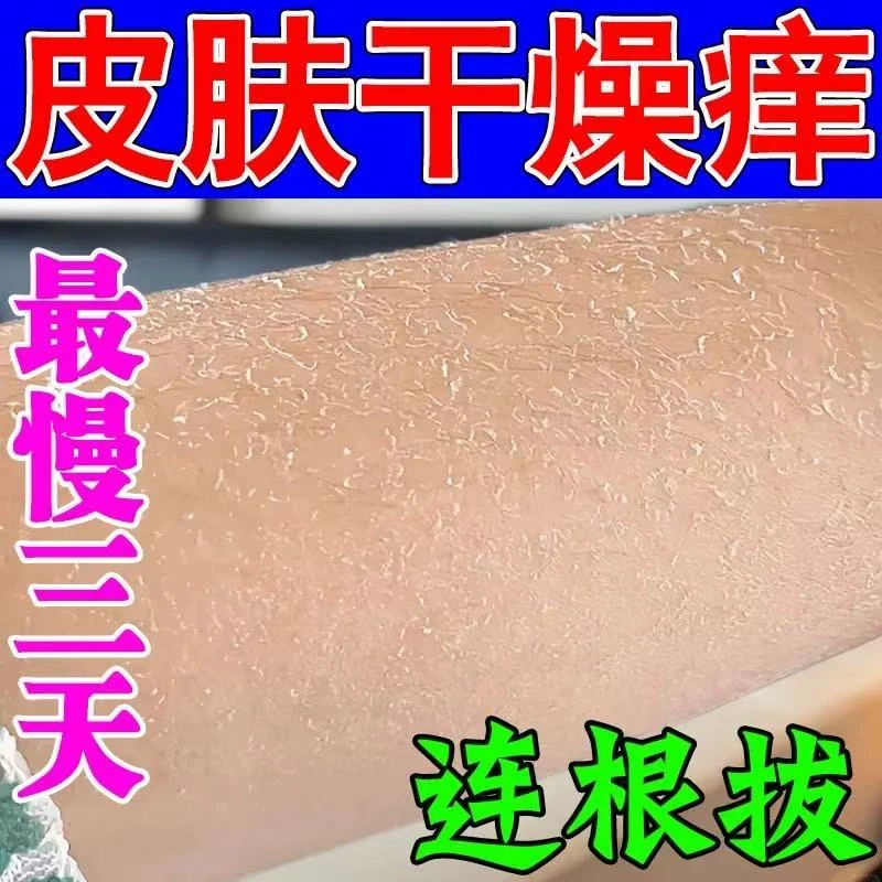 腿上干燥起皮小腿皮肤痒夏天皮肤干燥腿部起红点点疙瘩止痒抑菌膏