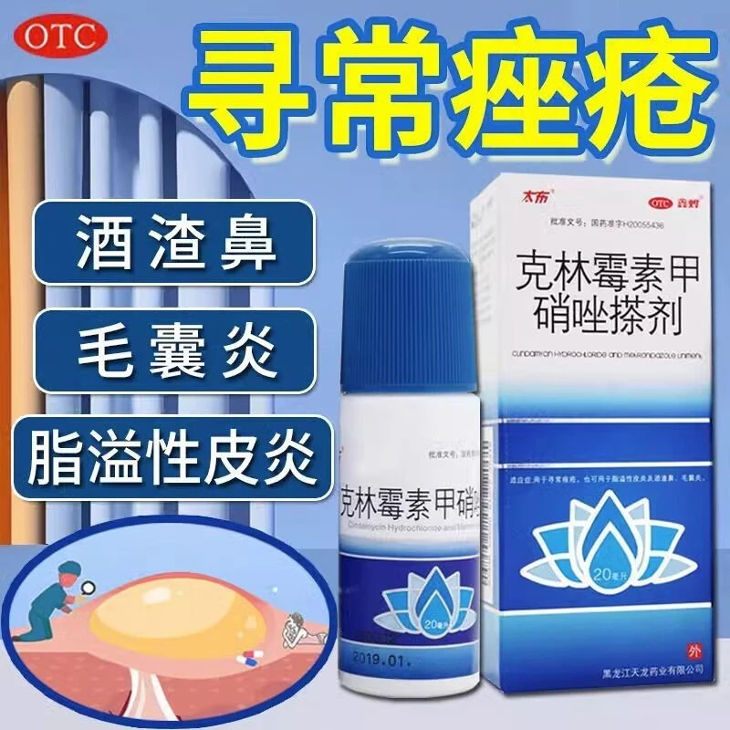 鑫烨太布 克林霉素甲硝唑搽剂 20ml 寻常痤疮脂溢性皮炎毛囊炎