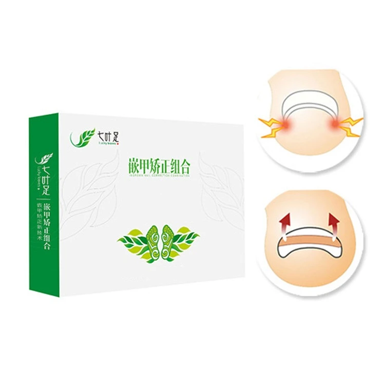 正甲贴嵌甲矫正器脚指甲往肉里长指甲扎肉里拉拉贴甲沟专用