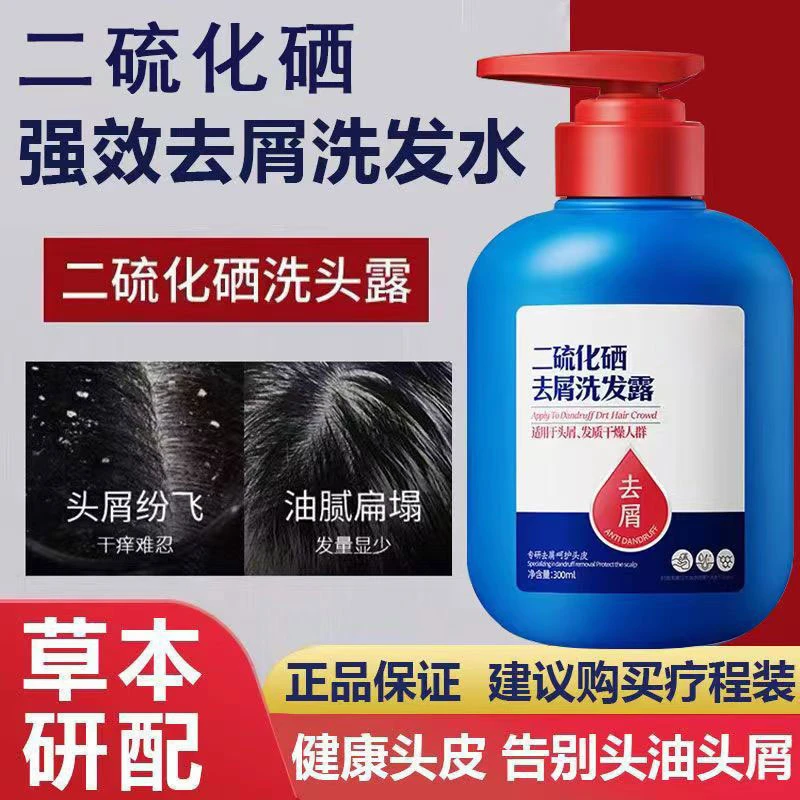 【官方正品】二硫化硒去屑洗发水控油止痒除螨滋润头皮清洁护发