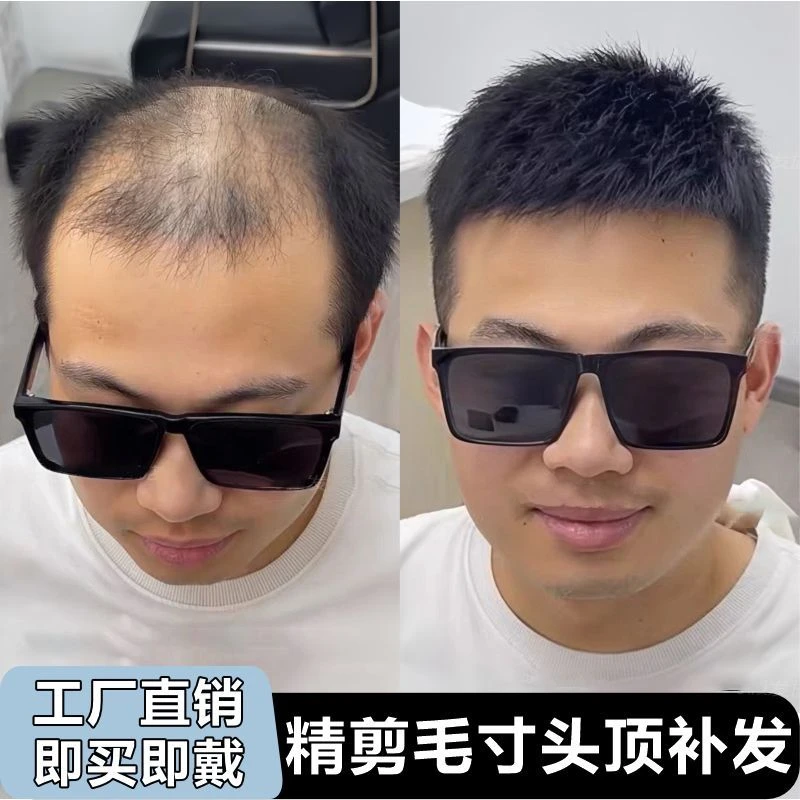 假发男士短发全真人发清爽毛寸精剪造型帅气男生头顶地中海补发片