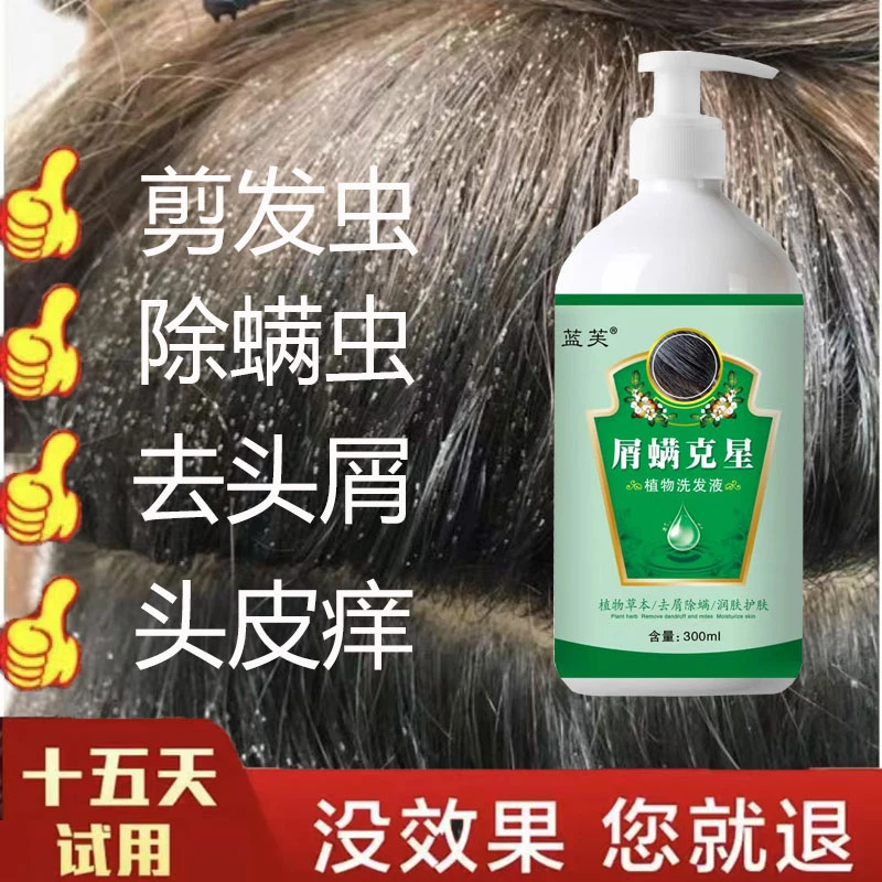 小孩剪发虫洗发水成人去屑止痒植物洗发液除螨控油洗头膏