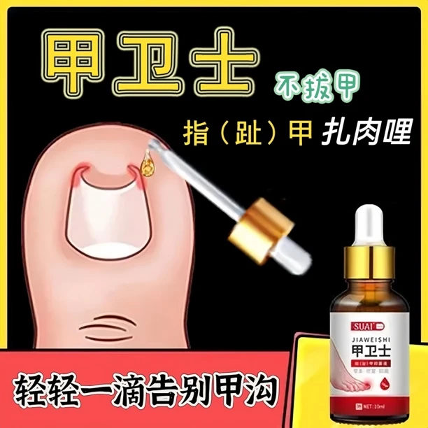 正品去甲沟甲卫士去肉芽手指脚趾甲长肉里修护液抑菌草本萃取