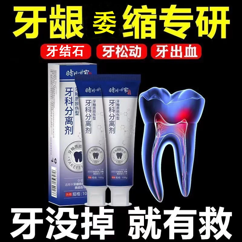 【官方正品】李时珍分离剂护龈固齿牙齿松动口腔配新小白管牙膏洁牙