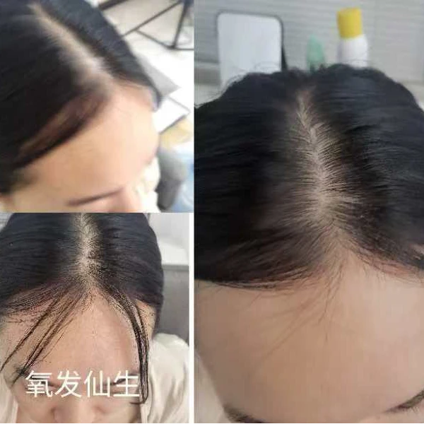 氧发仙生氧发仙生滋养修护头皮护理精华