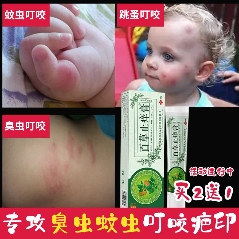 百草止痒膏被跳蚤咬臭虫蚊虫叮咬止痒膏儿童成人驱蚊皮肤瘙痒外用