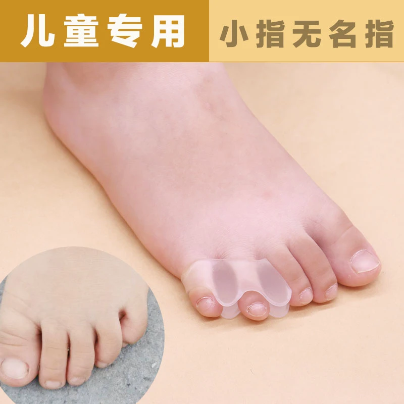 儿童婴幼儿小指无名指重叠弯曲内翻内歪分趾器分离器