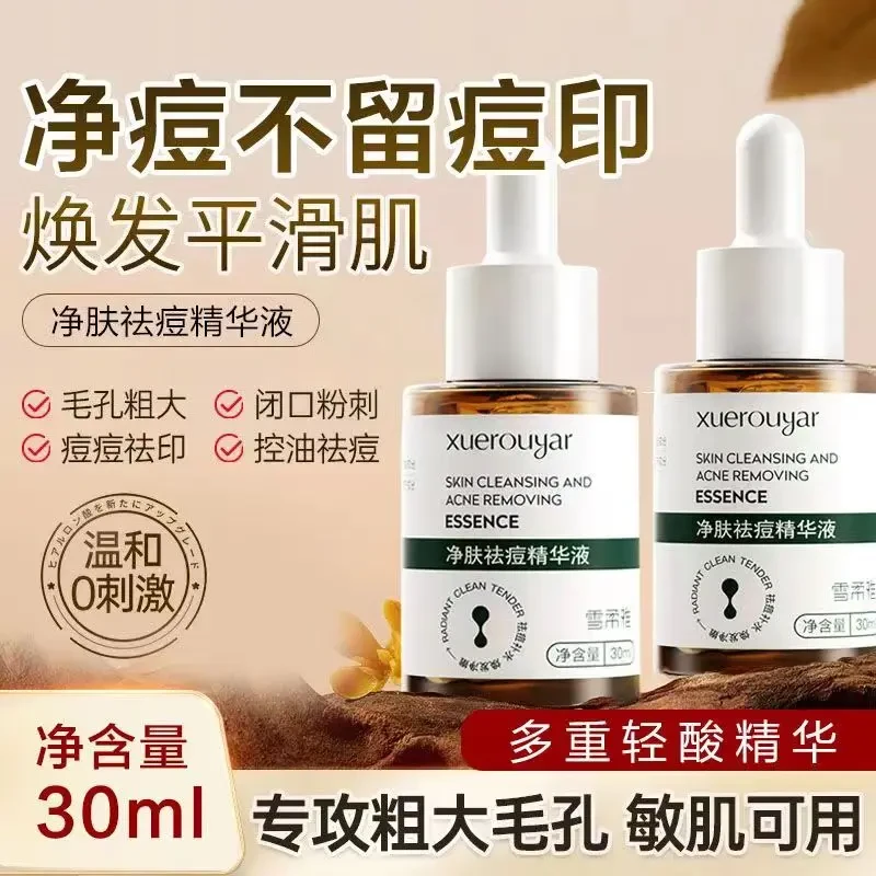 净肤祛痘细致毛孔精华液淡化痘印痘痕水杨酸壬二酸男士女专用正品