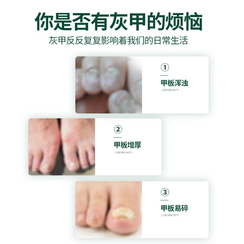 甲净液同甲亮甲抑菌护理液萃取温和足部护理液