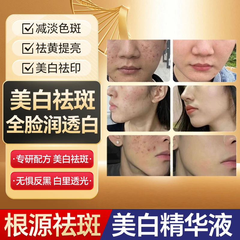 【拍一发二】ss444国妆祛1斑1液美白新品黑色素点斑修护淡斑霜遮瑕