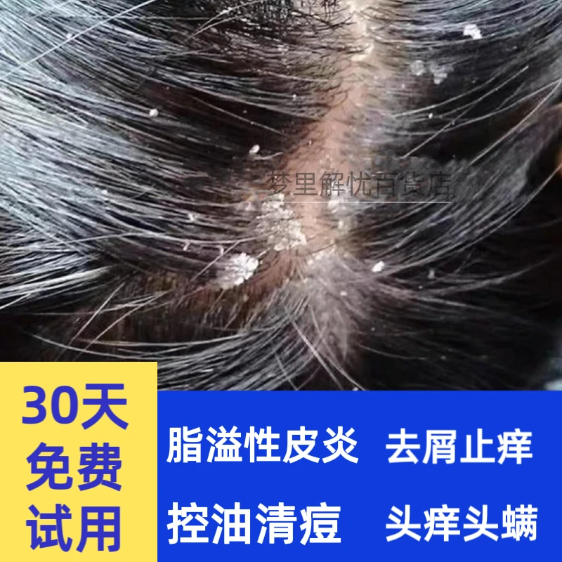 脂溢性皮洗发水炎止痒去油去大块头屑神器修研抑菌洗液煤焦油洗剂