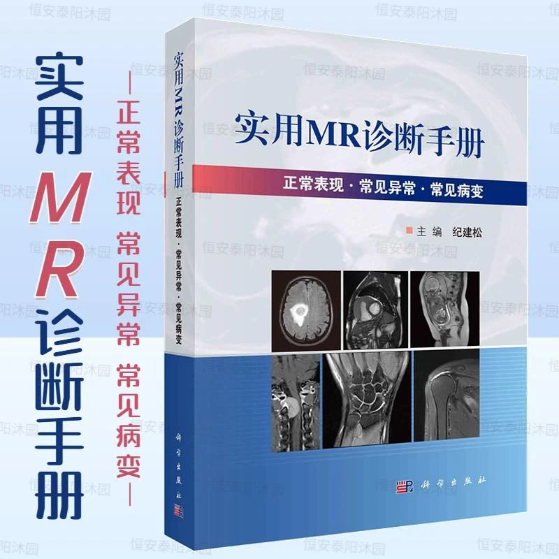 【正版新书】实用MR诊断手册 纪建松主编磁共振成像原理成像序列