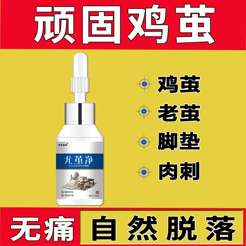 尤茧净去鸡茧老茧无痛肉刺手茧小脚趾关节茧脚底脚垫云南脚部本草