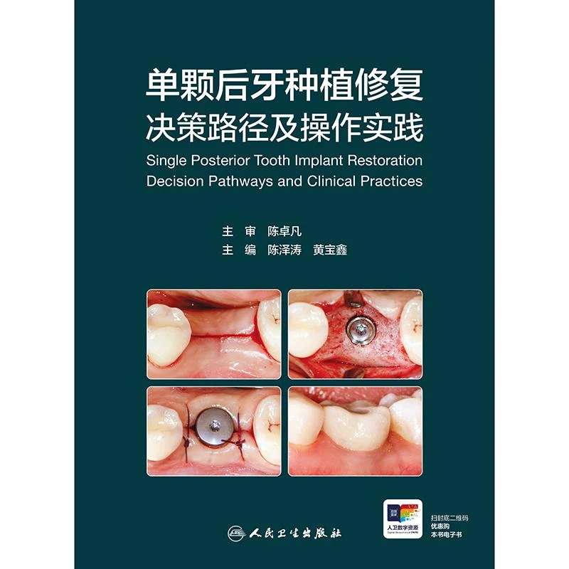 人卫单颗后牙种植修复决策路径及操作实践