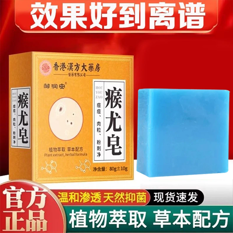 香港大药房瘊尤皂全身可用尤皂止痒猴子痘痘小肉粒清洁手工香皂