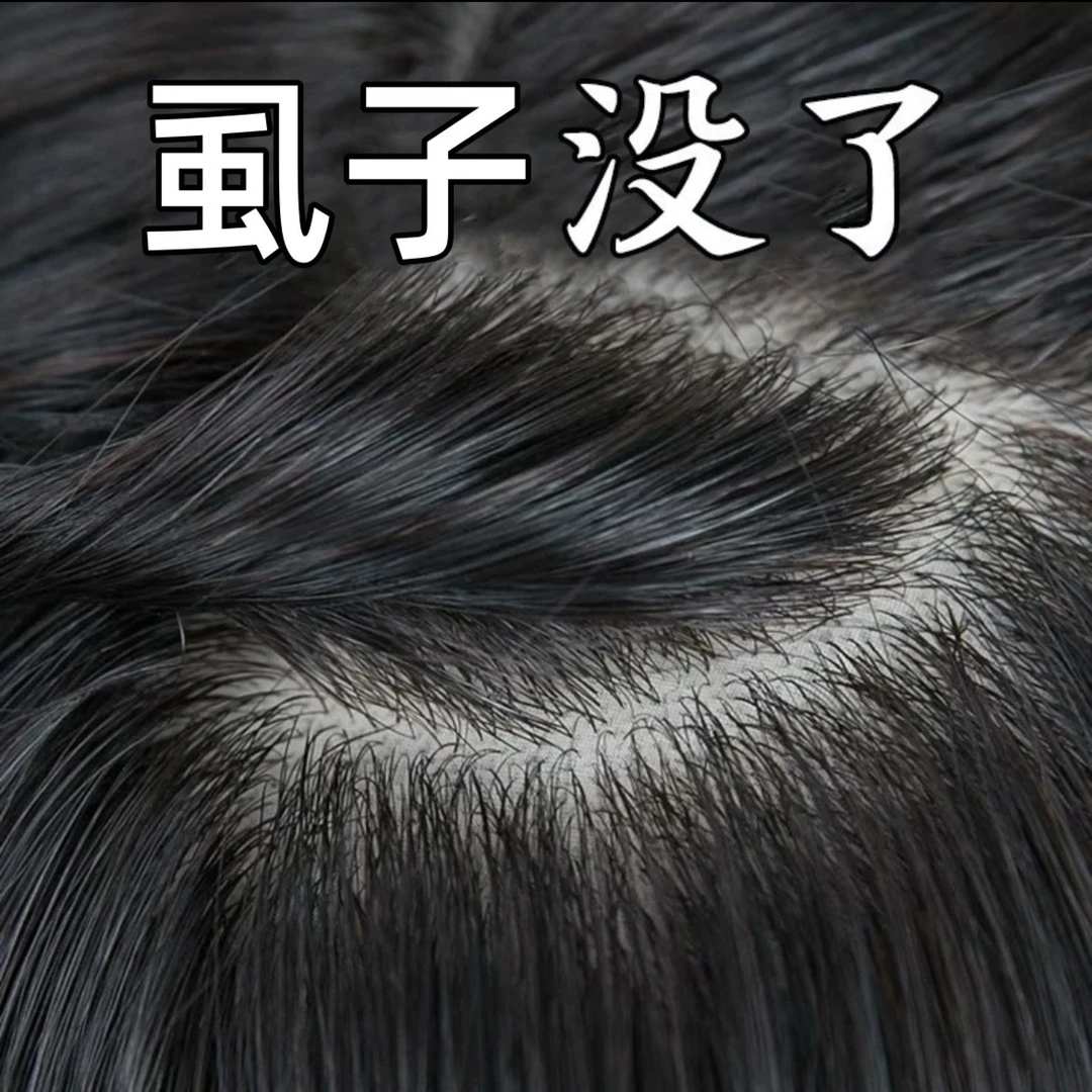 除小女孩头上发长的虱子洗发水祛虱卵香波儿童大人用虱立净百部酊