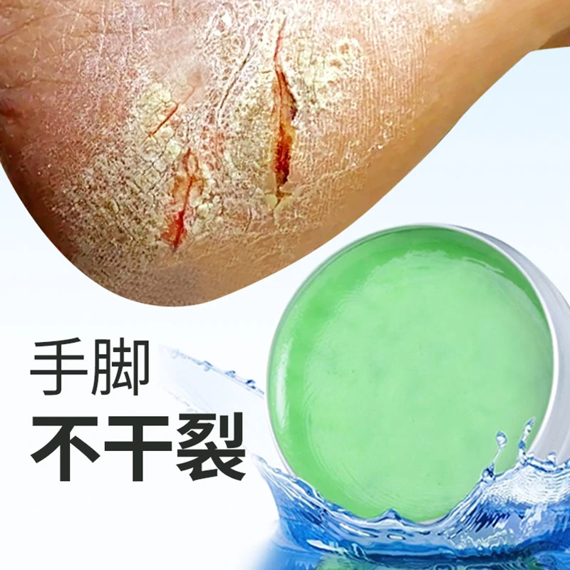 【BY艾灸伴侣】蕲春艾草香膏 30克大容量  蕲春蕲艾精油艾香膏
