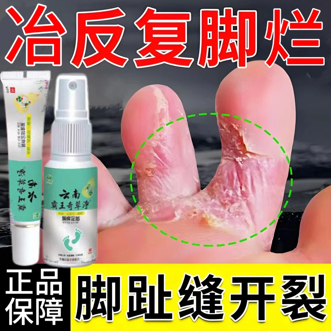 脚趾缝痒专用去脚痒脚臭气止痒神器脚丫脱皮抑菌膏开裂克星喷雾剂