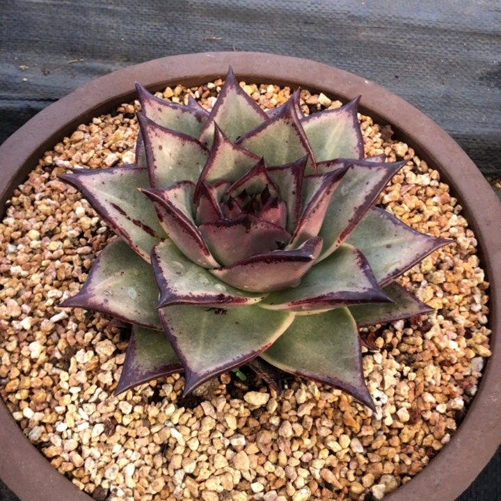 宽三角外翻00000000009