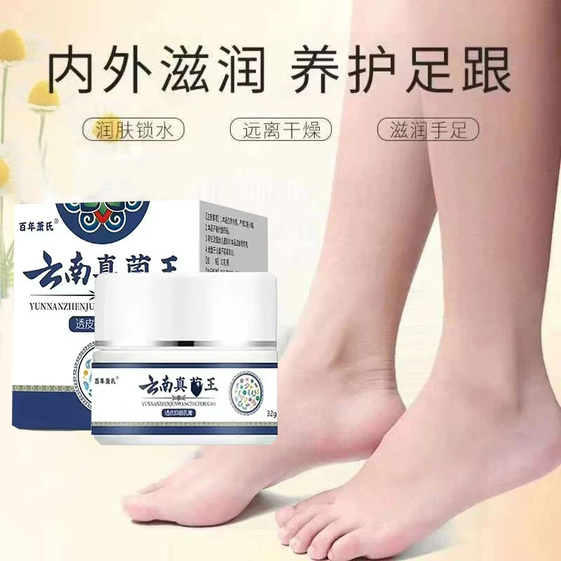正品云南真菌王脚后跟起皮粗糙干裂起硬皮手开口干裂防裂膏