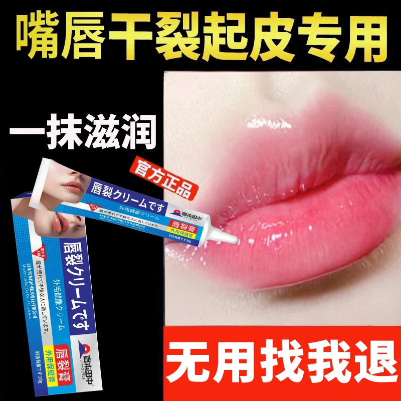 嘴唇干裂润唇膏嘴角干裂嘴角起皮滋润保湿防裂口嘴唇脱皮膏正品