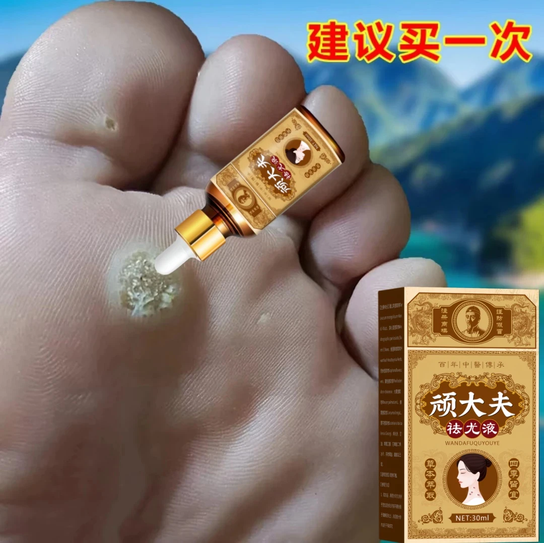 脚底鸡茧肉刺脚趾鸡厚皮茧走路疼脚钉脚发硬老茧死皮修护软化液c