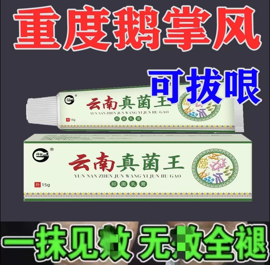 手足脱皮膏鹅掌风干裂脱皮手痒手裂口手足霜手足软膏脚干软膏
