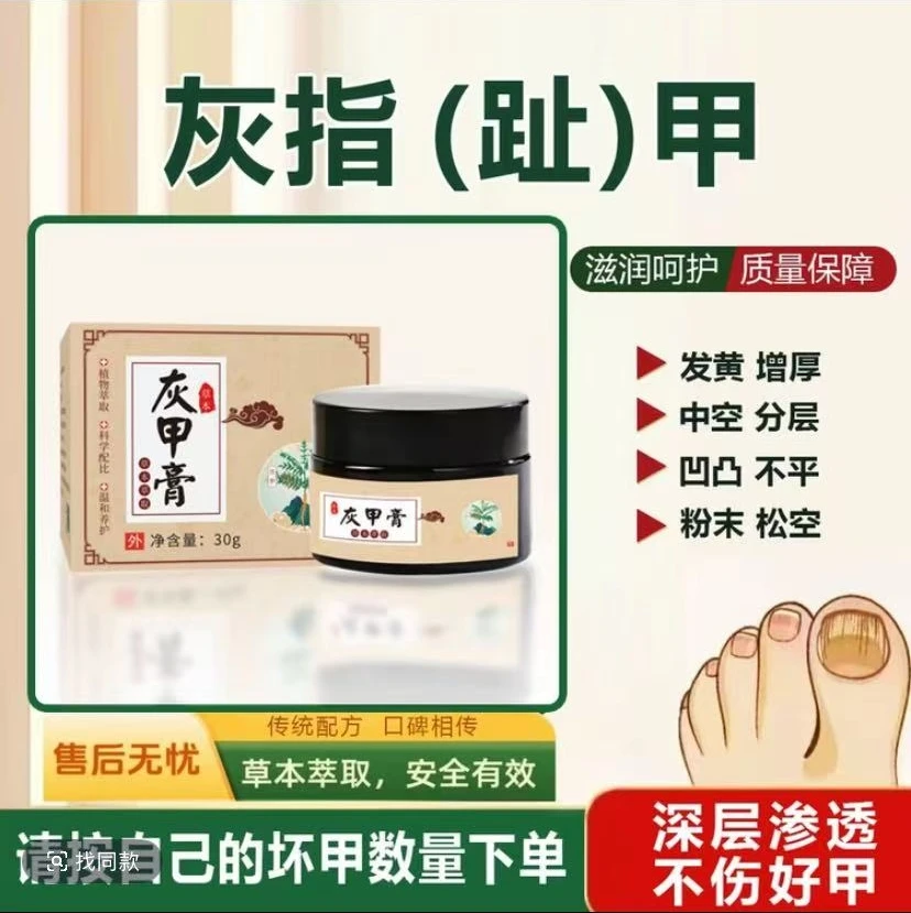 灰指（趾）甲植物萃取指甲抑菌乳膏家用草本