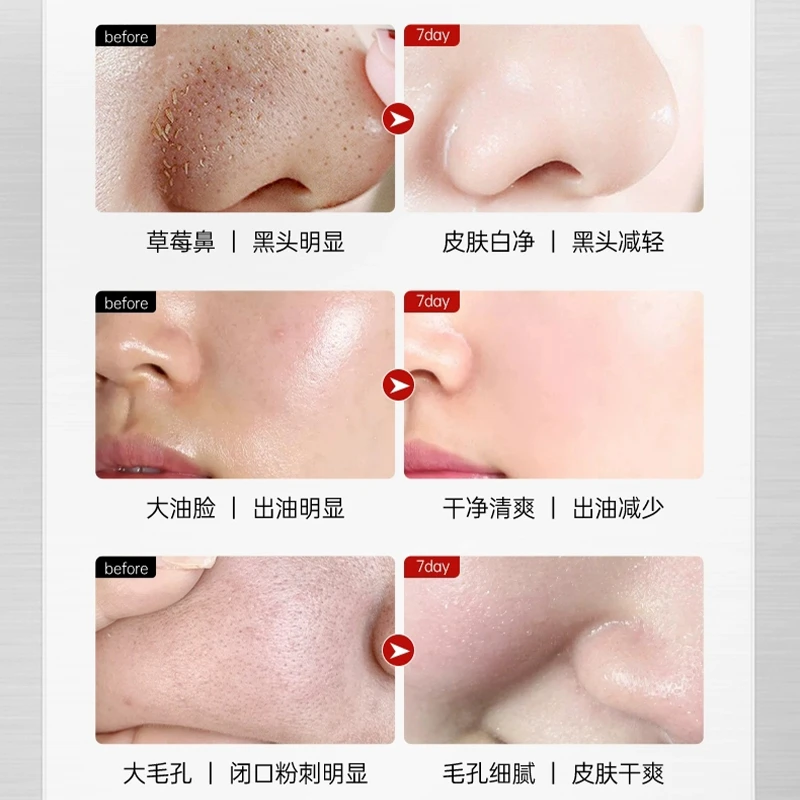 变美的秘密--女神必备古法草本植萃