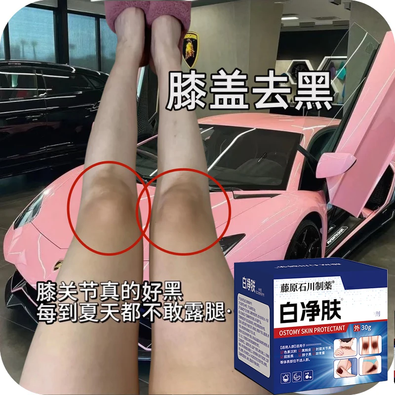 膝盖黑脖子黑棘皮膏关节黑色素沉着腋下黑屁股黑手肘大腿全身可用
