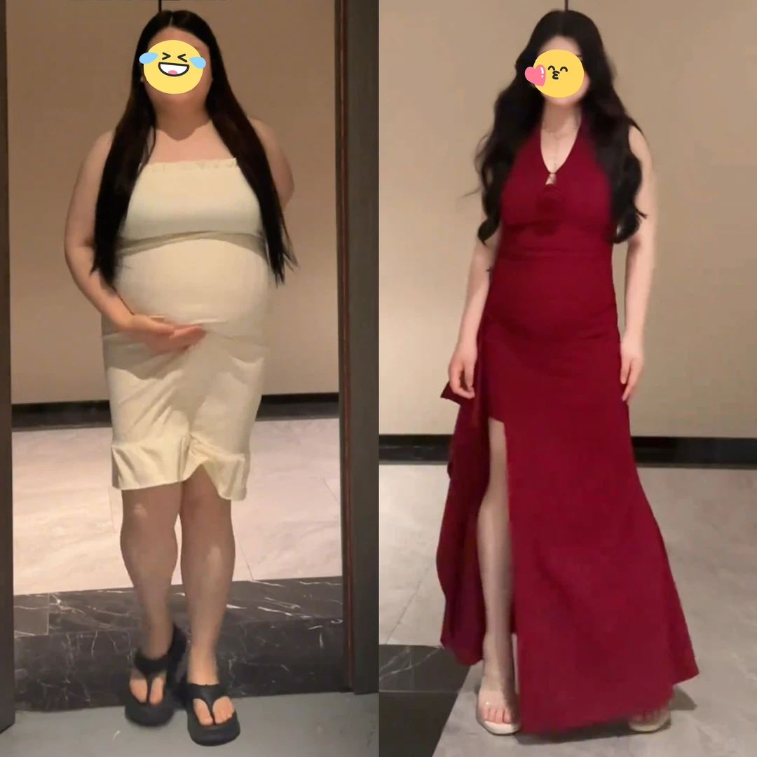 大码法式高级感挂脖连衣裙女夏季新款胖MM开叉高腰显瘦包臀长裙子