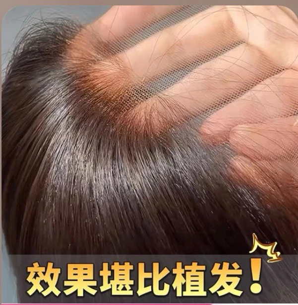 ［爽］“裸感无边”超隐形头顶补发片全真发，遮盖白发补充发
