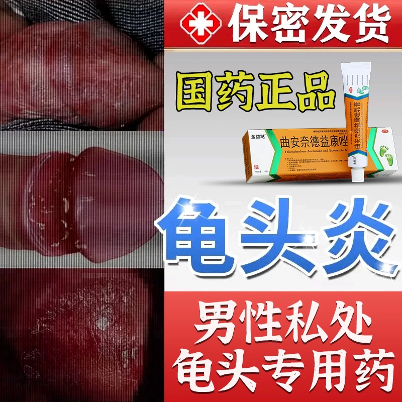 男性私处龟头药治疗龟头的专用药包皮垢皮炎冠状小红点红肿异味瘙痒抗菌抗炎抗过敏止痒龟头炎症金益跶曲安奈德益康唑乳膏18g