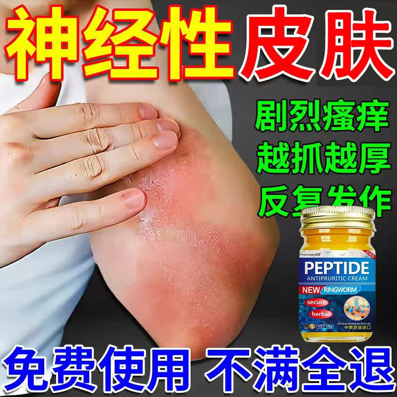 【神经性皮肤】脂溢性皮肤痒日光性皮肤痒全身可用清凉止痒外用乳膏