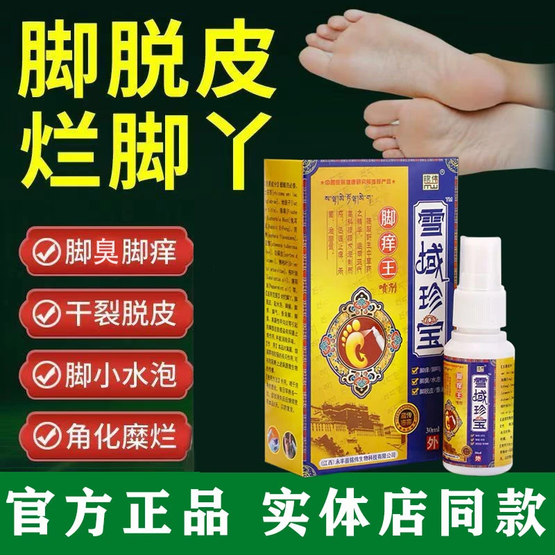 【主播推荐】脚/ 气专用去脚痒脚臭脚丫脱皮开裂抑杀菌止痒喷剂喷雾