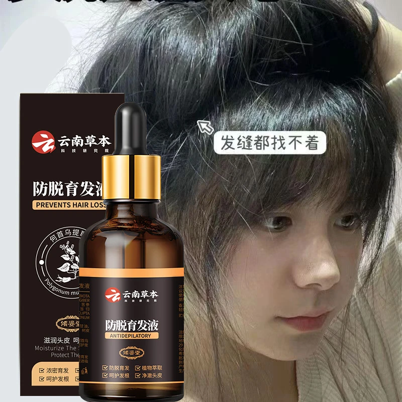 云南草本日出倾城毛发育发精华液养发草本萃取固发滋养柔顺dyey