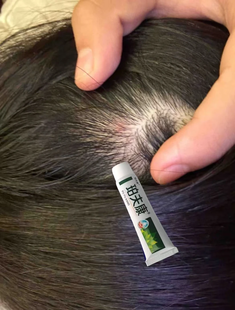 头皮毛囊起小红疙瘩脓包特效膏前胸后背毛囊痘止痒外用涂抹膏专用