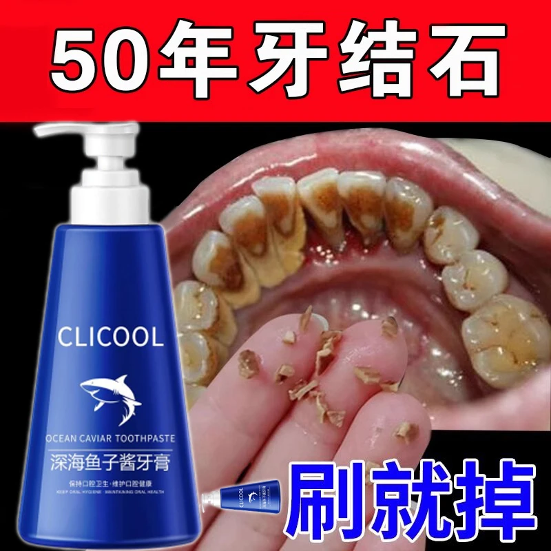 牙齿黑斑牙结石黑线牙斑去除烟牙黑牙牙缝发黑牙齿黑渍祛黑牙膏