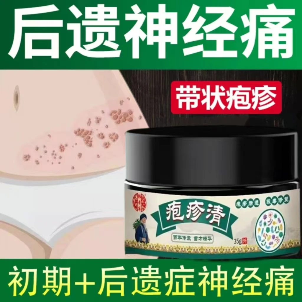 带状泡疹后遗症神经痛蛇盘疮膏去痛痒缠腰龙生直器疱疱疹清专用膏