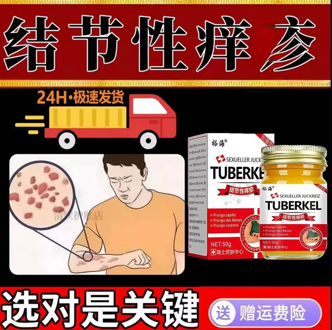 结节性痒珍膏硬块结痂红斑止痒去硬疙瘩寻麻诊结咔湿诊外用涂抹膏