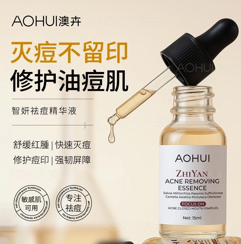 AOHUI/澳卉【痘痘闭口粉刺黑头】智妍祛痘精华液15ml