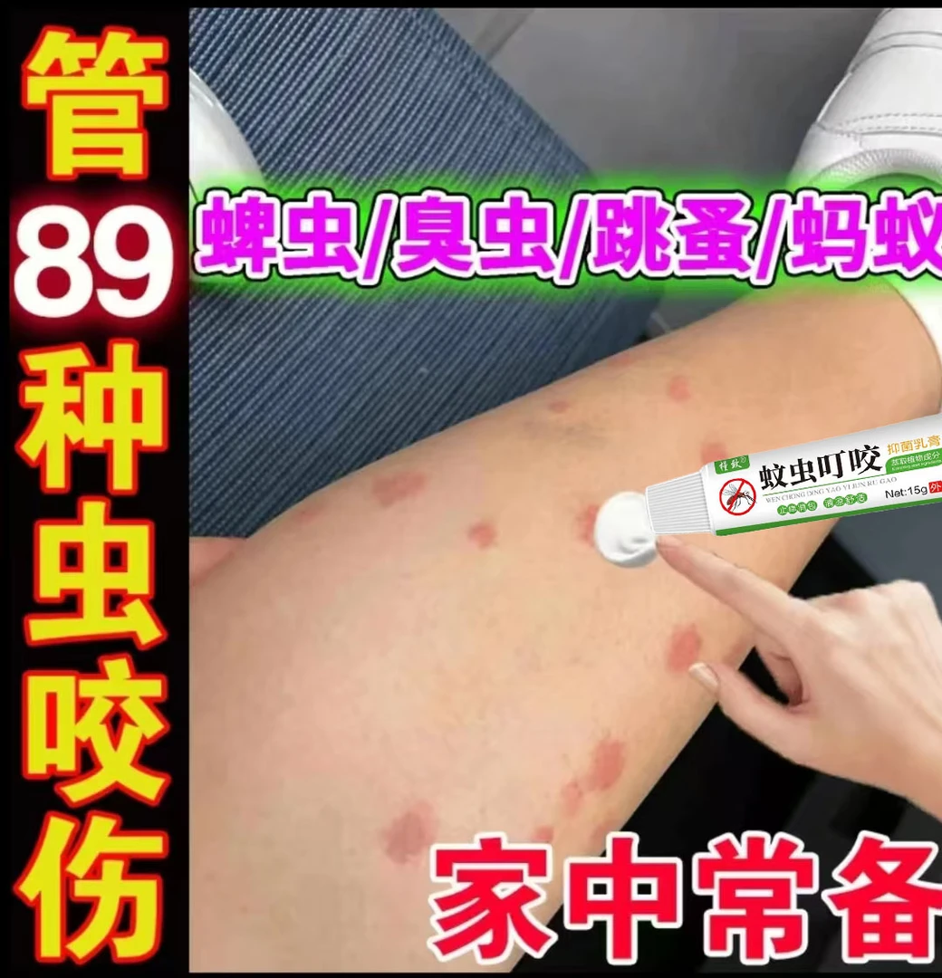 臭虫咬伤膏毒虫跳蚤叮咬止痒消肿消包膏艾草防蚊虫叮咬手足皲裂