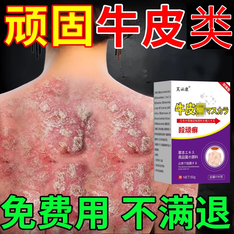 【支持试用】芙必康抑菌止痒全身可用草本外用涂抹牛*皮肤乳膏湿燥