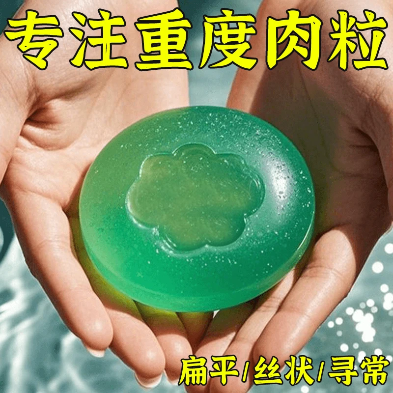 云医生肤康皂温和不刺激小肉粒疙瘩外用膏能洗掉瘊子的香皂
