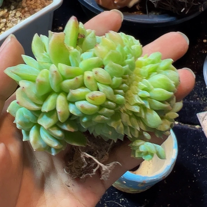 黄体生成异常和功能