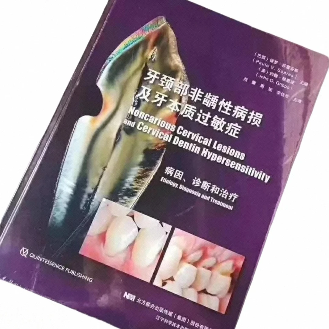 周锐推荐 楔缺 牙本质过敏症